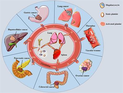 Challenges and Opportunities Associated With Platelets in Pancreatic Cancer